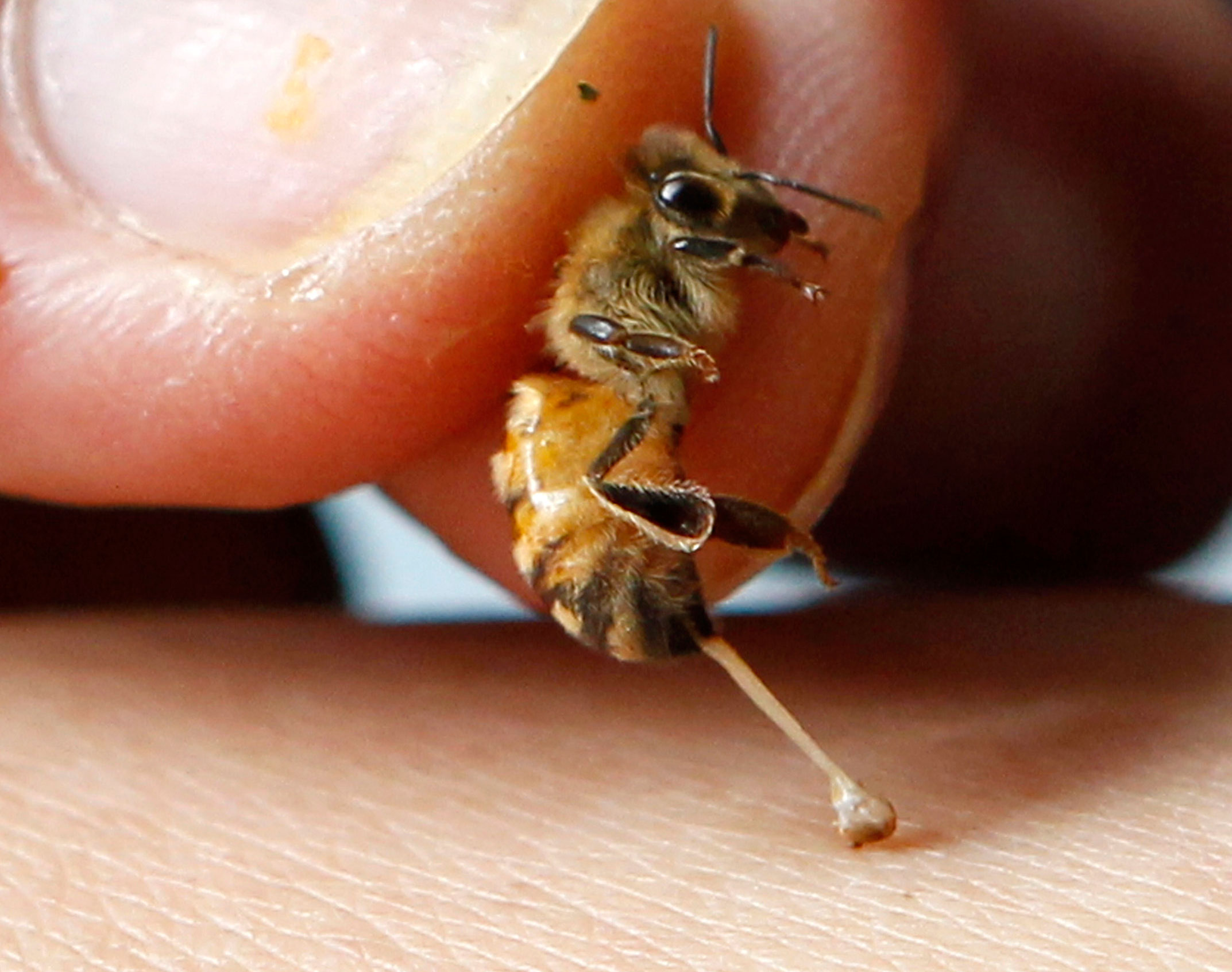 Close-up of a honey bee stinging human skin, with the stinger embedded and the bee pulling away